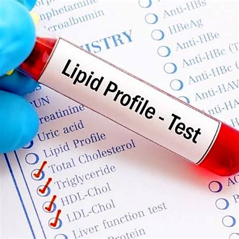 lipid profile test package|lipid profile lab test.